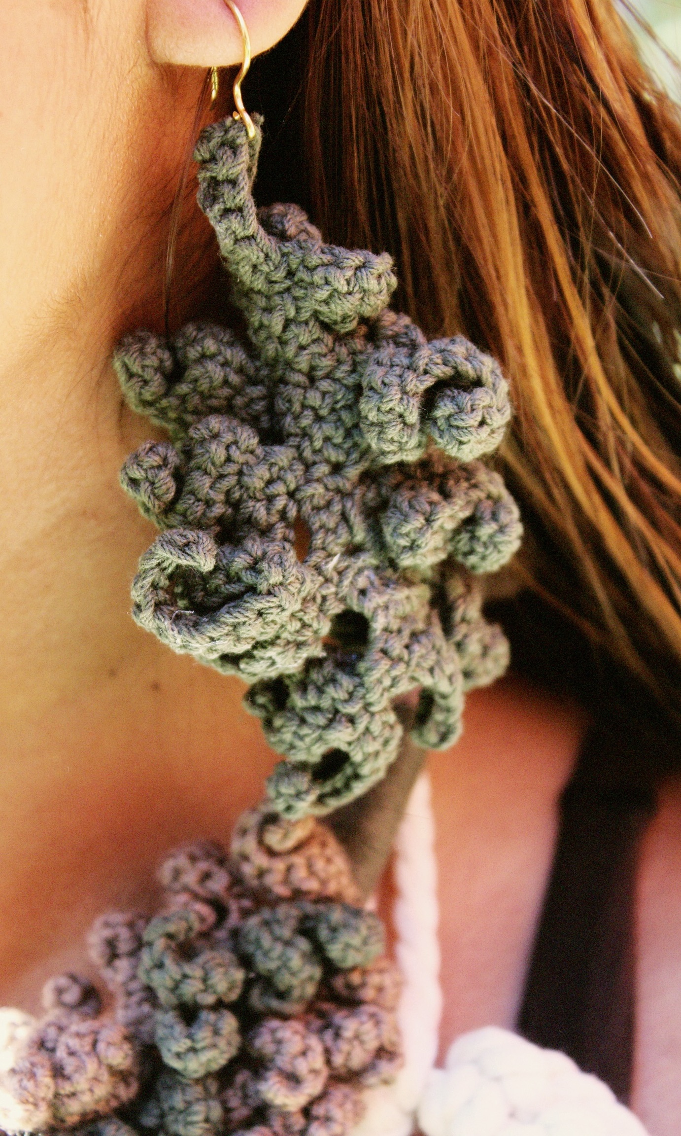 ARETES MUSGO